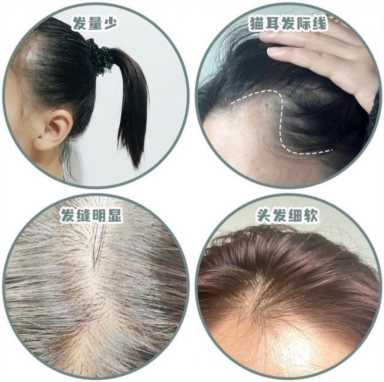 塌鼻子适合什么发型(塌鼻子适合什么发型女)