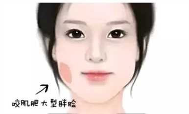 如何预防和改善“发腮”？