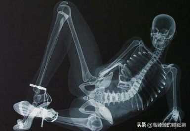 挖矿是怎么赚钱的？微信挖矿赚钱赚几百万