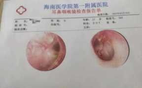 上课被同桌用手指抽插好爽，缘何选择诉诸暴力的人