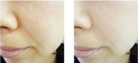 去黑头的产品(去黑头的产品有用吗)插图23 终于找到你!原来最好用的去黑头产品竟然隐藏在卸妆界