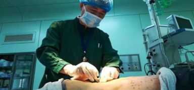 神奇的“小针刀”，到底是针还是刀？