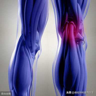 十字韧带断裂,韧带断裂的原因以及治疗方法视频插图3 韧带断裂的原因以及治疗方法