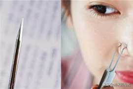 粉刺针怎么去黑头图解 用对方法很重要