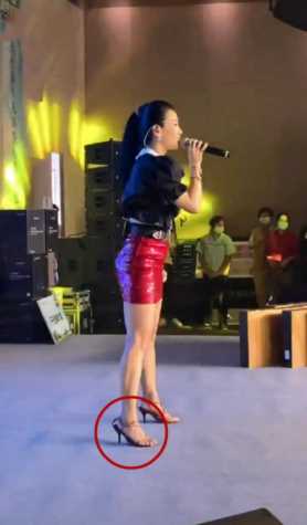 王蓉整容前后照片，王蓉整容安检