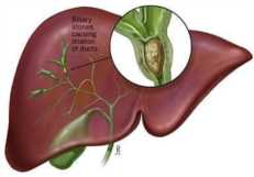 辟谣：碱性磷酸酶高，代表肝功能不好？听听医生怎么说