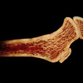 辟谣：碱性磷酸酶高，代表肝功能不好？听听医生怎么说