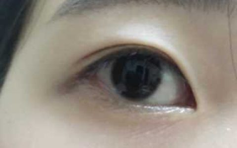 双眼皮贴怎么剪，肿眼泡双眼皮贴正确贴法
