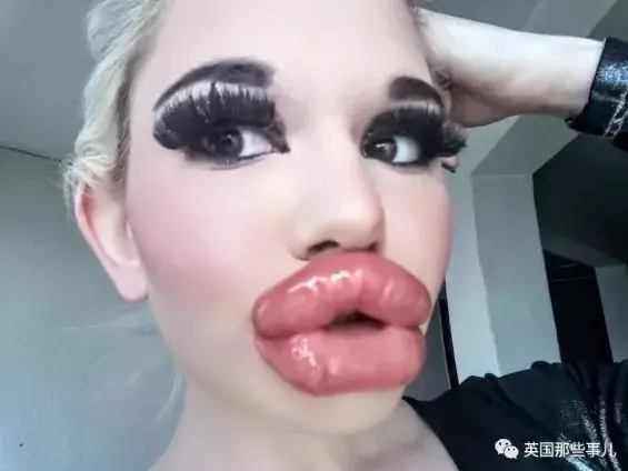 20次丰唇手术，她把自己整成了“世界上嘴唇最厚”的真人芭比