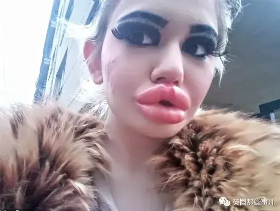 20次丰唇手术，她把自己整成了“世界上嘴唇最厚”的真人芭比