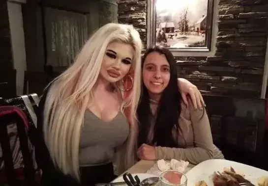 20次丰唇手术，她把自己整成了“世界上嘴唇最厚”的真人芭比