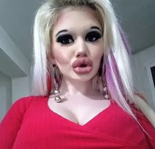 20次丰唇手术，她把自己整成了“世界上嘴唇最厚”的真人芭比