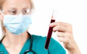 验血能查出什么，血常规怎么看病毒和细菌感染