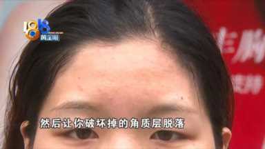 “果酸焕肤”又红又肿，老公都不跟自己说话了