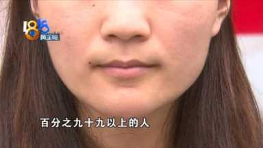 “果酸焕肤”又红又肿，老公都不跟自己说话了