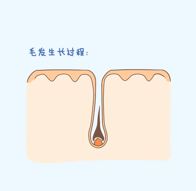 脱毛招式千千万！激光脱毛真的适合所有人吗？