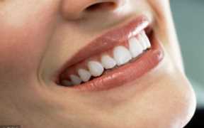 四环素牙美白,牙齿四环素牙怎么美白