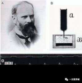 心电图九九八十一难之二爱因托芬三角和肢体导联