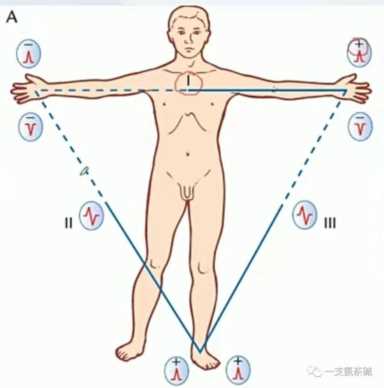 心电图九九八十一难之二爱因托芬三角和肢体导联