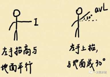 心电图九九八十一难之二爱因托芬三角和肢体导联