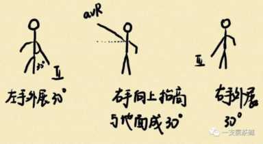 心电图九九八十一难之二爱因托芬三角和肢体导联