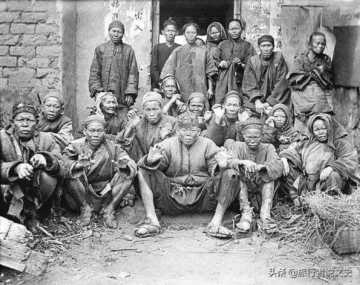 风疾是什么病,麻风病最早起源于插图1 让卢照邻不堪忍受其苦的麻风病,灭绝了吗?