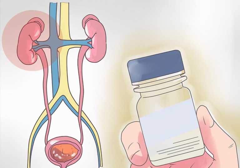 肾内科的病人,肾内科常见疾病及护理