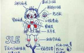蝶形红斑，脸颊发红和蝶形红斑的区别