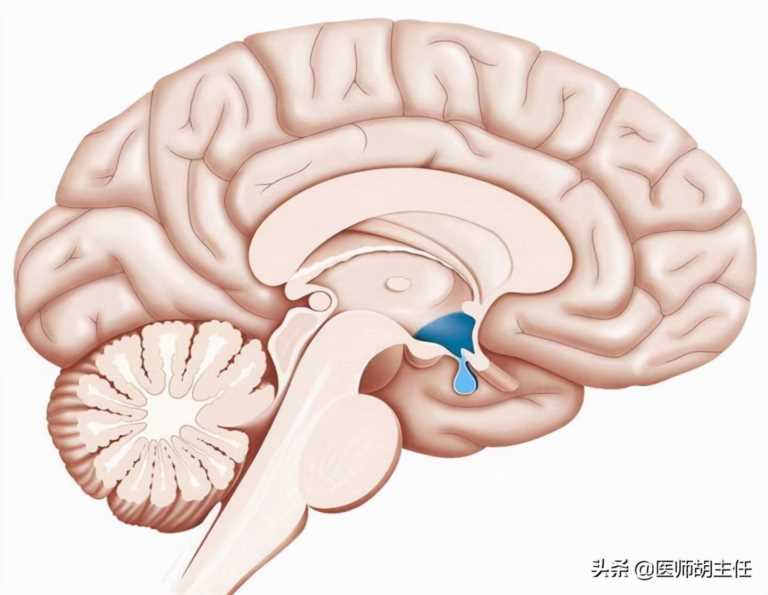 安乃近多少度可以吃,安乃近和布洛芬哪个好插图3 安乃近多少度可以吃,安乃近和布洛芬哪个好