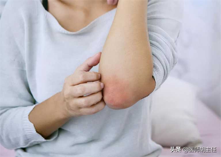 安乃近多少度可以吃,安乃近和布洛芬哪个好插图7 安乃近多少度可以吃,安乃近和布洛芬哪个好