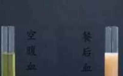 验血空腹的要求,空腹抽血怎么算空腹