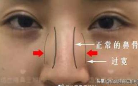 怎样让鼻孔缩小，鼻骨内推脸会变小吗