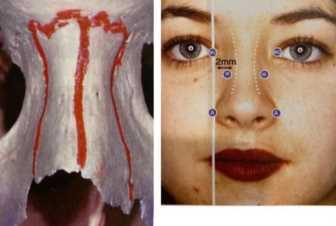 科学变美｜怎么提高正脸颜值，鼻骨内推必须了解