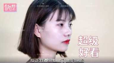 科学变美｜怎么提高正脸颜值，鼻骨内推必须了解