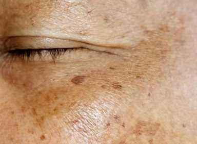 92岁陈可冀院士研究血脂50年，劝告：除肉类外，7种素食嘴下留情