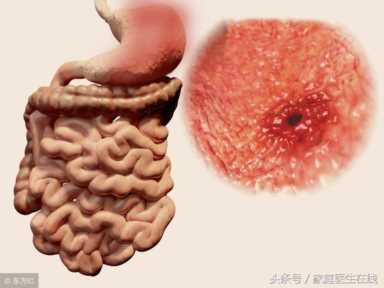 常喝红茶的人，身体与常人会有5个“不同”！看到的人真幸运